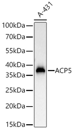 Tartrate Resistant Acid Phosphatase Antibody in Western Blot (WB)