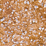 Aquaporin 4 Antibody in Immunohistochemistry (Paraffin) (IHC (P))