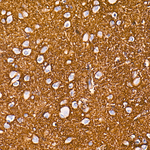 Aquaporin 4 Antibody in Immunohistochemistry (Paraffin) (IHC (P))