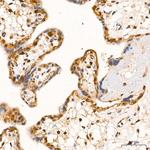 PSMB1 Antibody in Immunohistochemistry (Paraffin) (IHC (P))