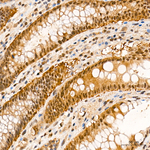 PSMB1 Antibody in Immunohistochemistry (Paraffin) (IHC (P))