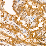 PSMB1 Antibody in Immunohistochemistry (Paraffin) (IHC (P))