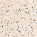 PSMB1 Antibody in Immunohistochemistry (Paraffin) (IHC (P))