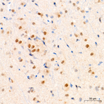 PSMB1 Antibody in Immunohistochemistry (Paraffin) (IHC (P))
