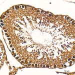 ZNF9 Recombinant Rabbit Monoclonal Antibody (2J3D7)