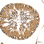 ZNF9 Antibody in Immunohistochemistry (Paraffin) (IHC (P))