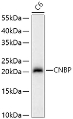 ZNF9 Antibody in Western Blot (WB)