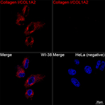COL1A2 Recombinant Rabbit Monoclonal Antibody (1M8Z7)