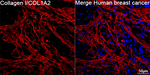 COL1A2 Antibody in Immunohistochemistry (Paraffin) (IHC (P))