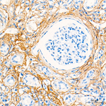 COL1A2 Antibody in Immunohistochemistry (Paraffin) (IHC (P))