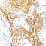 COL1A2 Antibody in Immunohistochemistry (Paraffin) (IHC (P))