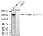 COL1A2 Antibody in Western Blot (WB)