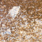 EXT1 Antibody in Immunohistochemistry (Paraffin) (IHC (P))