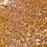 EXT1 Antibody in Immunohistochemistry (Paraffin) (IHC (P))