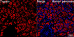 Trypsin Antibody in Immunohistochemistry (Paraffin) (IHC (P))