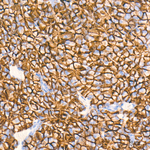 CD98 Antibody in Immunohistochemistry (Paraffin) (IHC (P))