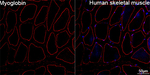 Myoglobin Antibody in Immunohistochemistry (Paraffin) (IHC (P))