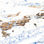 Myoglobin Antibody in Immunohistochemistry (Paraffin) (IHC (P))