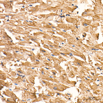 Myoglobin Antibody in Immunohistochemistry (Paraffin) (IHC (P))