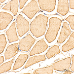 Myoglobin Antibody in Immunohistochemistry (Paraffin) (IHC (P))