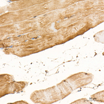 Myoglobin Antibody in Immunohistochemistry (Paraffin) (IHC (P))