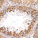 MKL1 Antibody in Immunohistochemistry (Paraffin) (IHC (P))