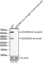 DFNA5 Recombinant Rabbit Monoclonal Antibody (9B3K0)