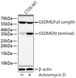 DFNA5 Antibody in Western Blot (WB)