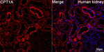 CPT1A Antibody in Immunohistochemistry (Paraffin) (IHC (P))