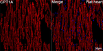 CPT1A Antibody in Immunohistochemistry (Paraffin) (IHC (P))