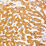CPT1A Antibody in Immunohistochemistry (Paraffin) (IHC (P))
