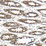 CPT1A Antibody in Immunohistochemistry (Paraffin) (IHC (P))
