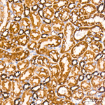 CPT1A Antibody in Immunohistochemistry (Paraffin) (IHC (P))