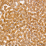 CPT1A Antibody in Immunohistochemistry (Paraffin) (IHC (P))
