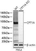 CPT1A Antibody in Western Blot (WB)
