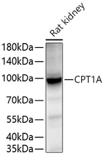 CPT1A Antibody in Western Blot (WB)