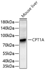 CPT1A Antibody in Western Blot (WB)