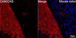 Creatine Kinase MB Recombinant Mouse Monoclonal Antibody (7R7I9)