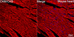 Creatine Kinase MB Antibody in Immunohistochemistry (Paraffin) (IHC (P))