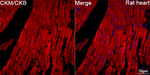 Creatine Kinase MB Antibody in Immunohistochemistry (Paraffin) (IHC (P))