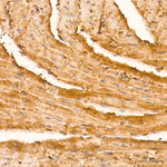 Creatine Kinase MB Antibody in Immunohistochemistry (Paraffin) (IHC (P))