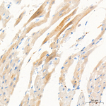 Creatine Kinase MB Antibody in Immunohistochemistry (Paraffin) (IHC (P))