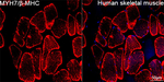 MYH7 Antibody in Immunohistochemistry (Paraffin) (IHC (P))