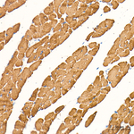 MYH7 Antibody in Immunohistochemistry (Paraffin) (IHC (P))
