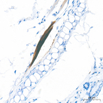 MYH7 Antibody in Immunohistochemistry (Paraffin) (IHC (P))