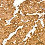 MYH7 Antibody in Immunohistochemistry (Paraffin) (IHC (P))