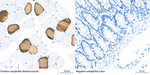 MYH7 Antibody in Immunohistochemistry (Paraffin) (IHC (P))