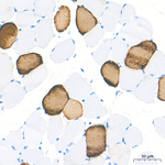 MYH7 Antibody in Immunohistochemistry (Paraffin) (IHC (P))