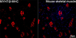 MYH7 Antibody in Immunohistochemistry (Paraffin) (IHC (P))