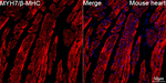 MYH7 Antibody in Immunohistochemistry (Paraffin) (IHC (P))